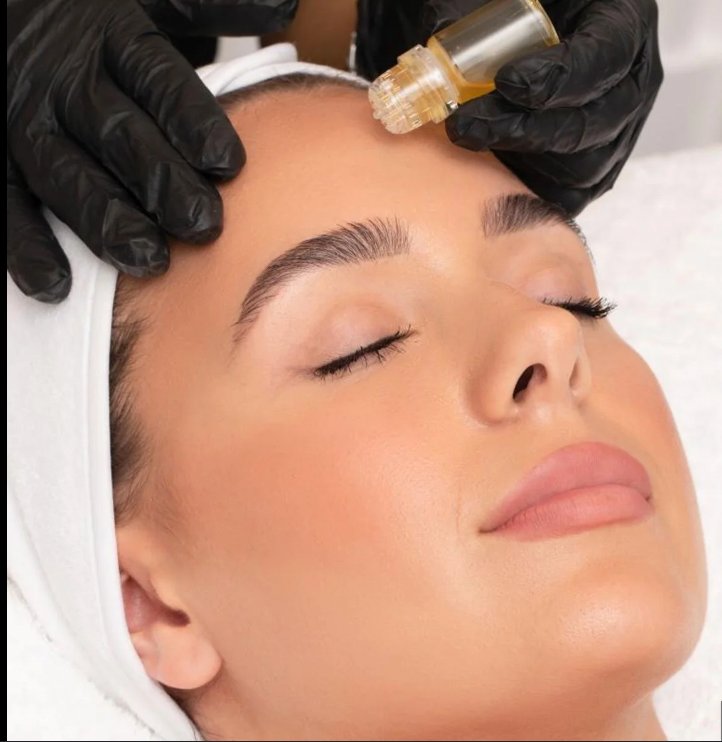 Aquagold Korean Glass Skin Facial at Brows & Botox Med Spa
