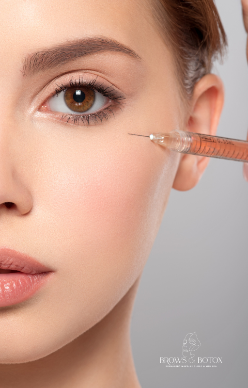Sculptra and Radiesse treatment at Brows & Botox Med Spa
